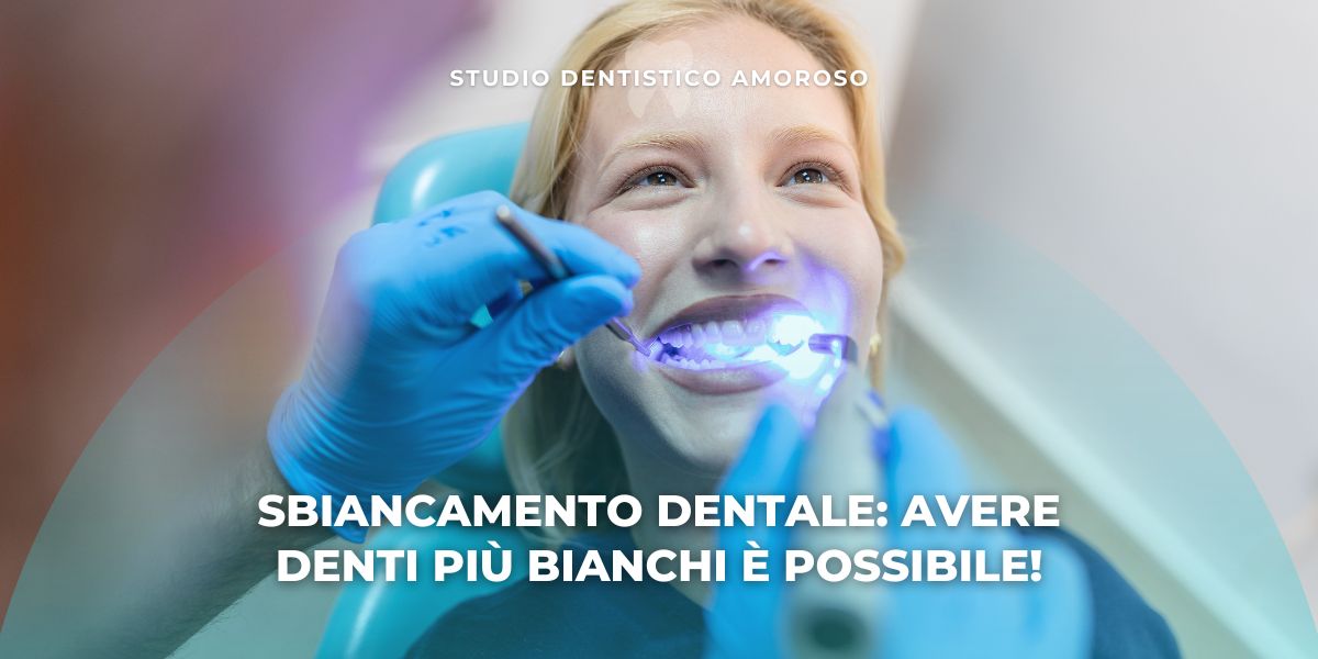 Denti più bianchi dopo lo sbiancamento dentale