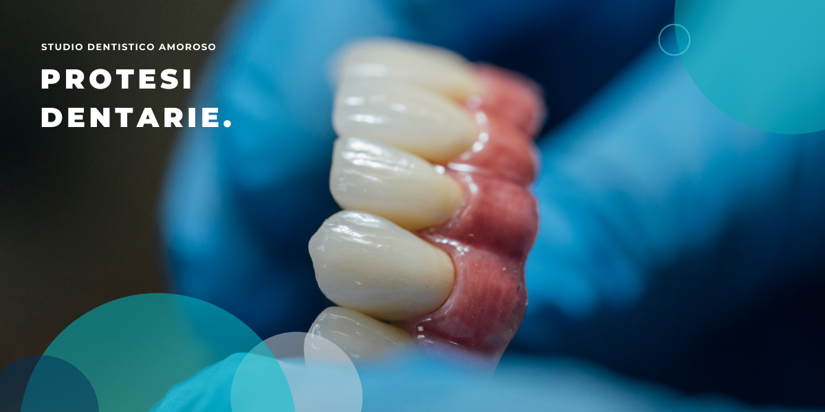 Esempio di protesi dentarie tra le mani del dentista