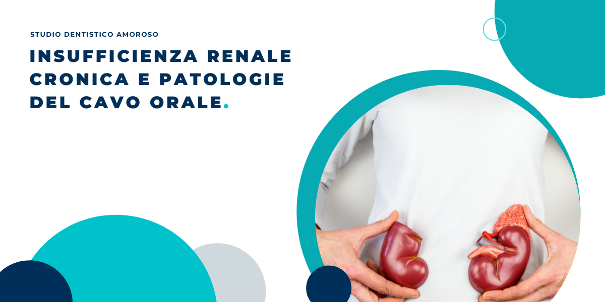 Insufficienza renale cronica e patologie del cavo orale