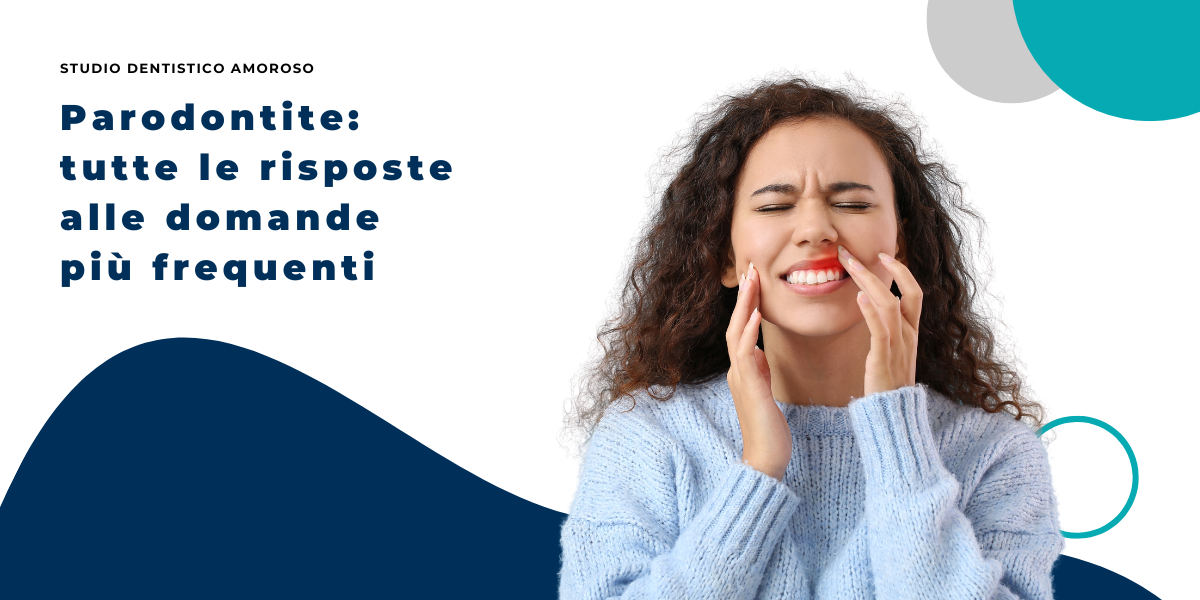Parodontite: tutte le risposte alle domande più frequenti