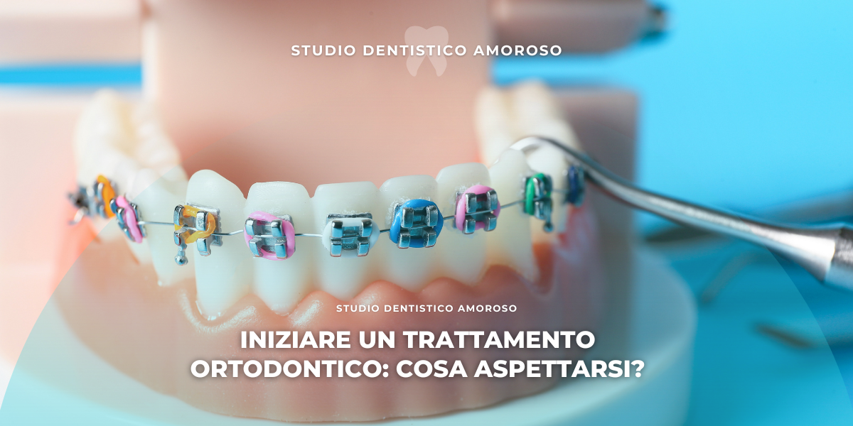 Apparecchio per il trattamento ortodontico