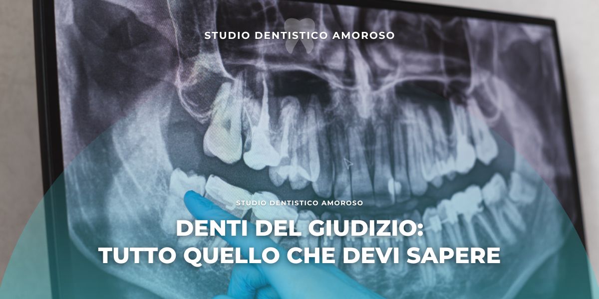 Denti del giudizio: tutto quello che devi sapere