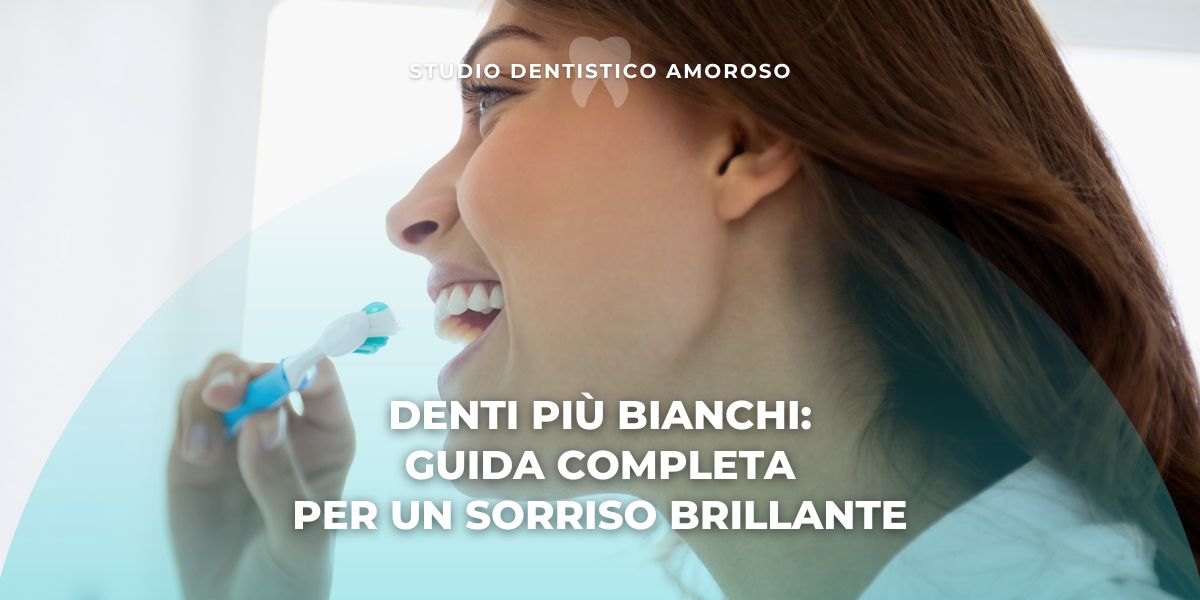 Denti-più-bianchi-guida-completa-sorriso-brillante Denti più bianchi: guida completa per un sorriso brillante