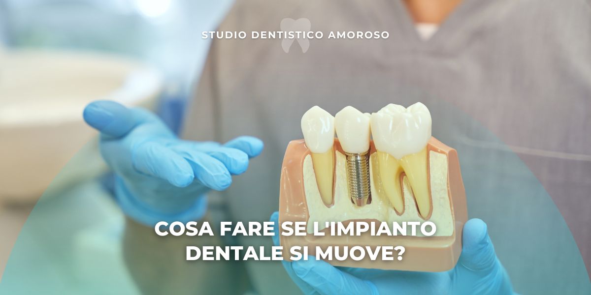 Dentista che spiega cosa fare se l'impianto dentale si muove