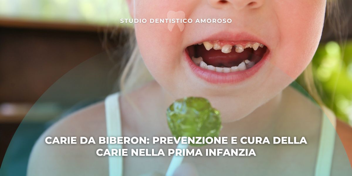 Dettaglio di bambina affetta da carie nella prima infanzia
