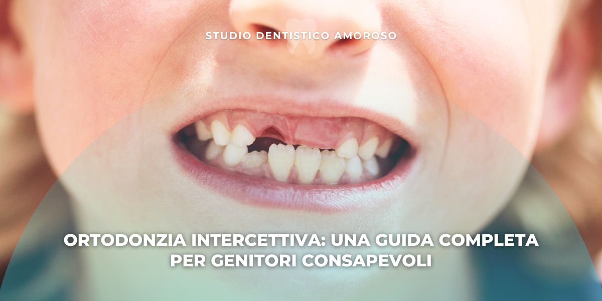 La fase di sviluppo dei denti nei bambini è quella in cui agisce l'ortodonzia intercettiva
