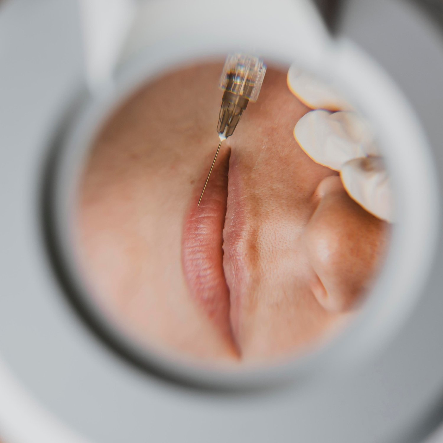 2148825338-8 Medicina estetica Torino