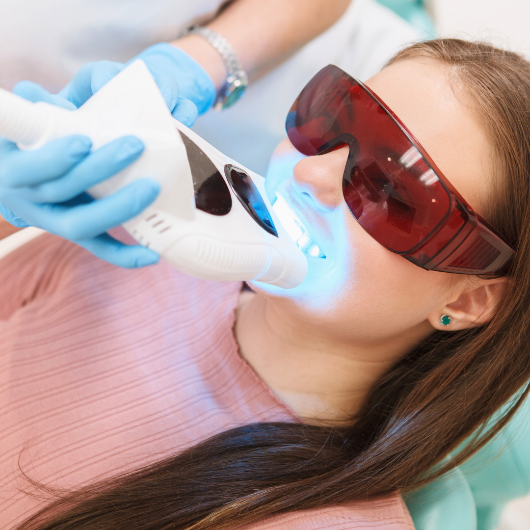 sbiancamento Odontoiatria estetica
