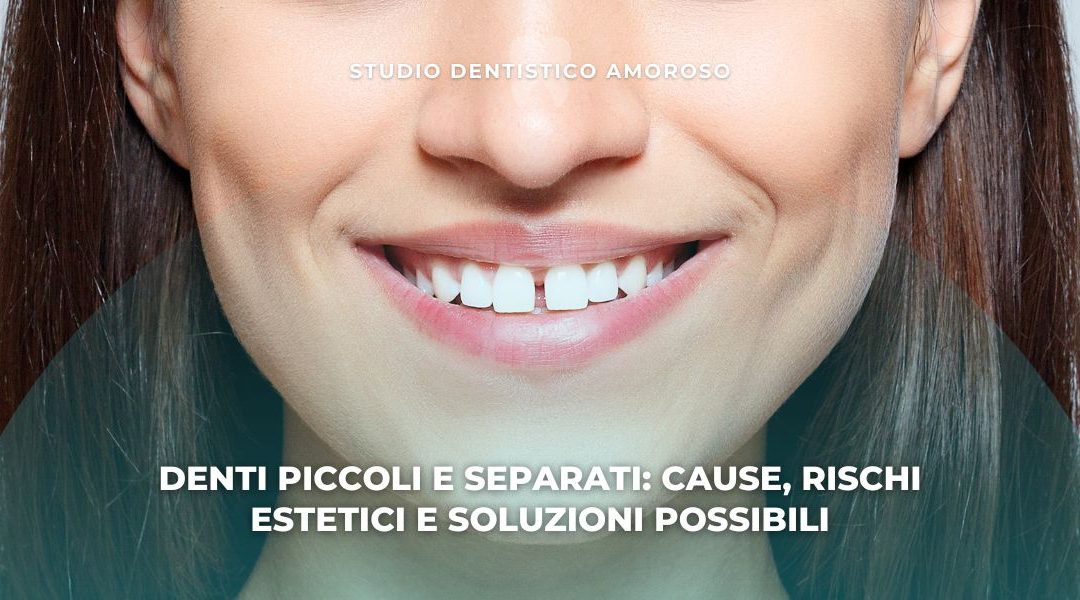 Denti piccoli e separati: cause, rischi estetici e soluzioni possibili