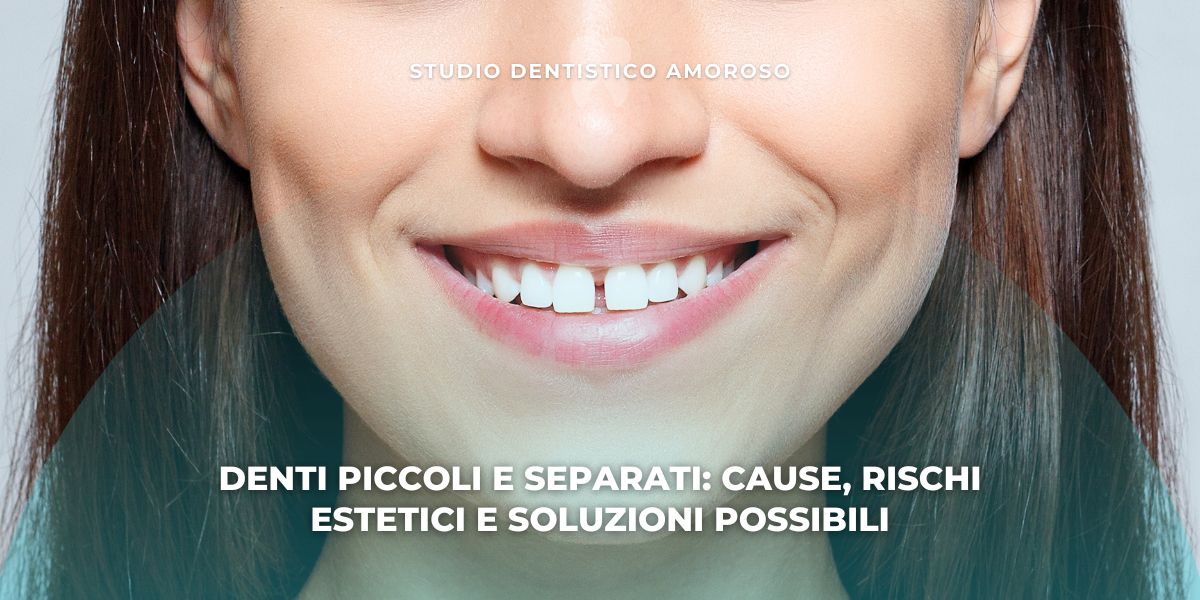 Sorriso di una persona con denti piccoli e separati, esempio di diastemi dentali e proporzioni ridotte dei denti anteriori.