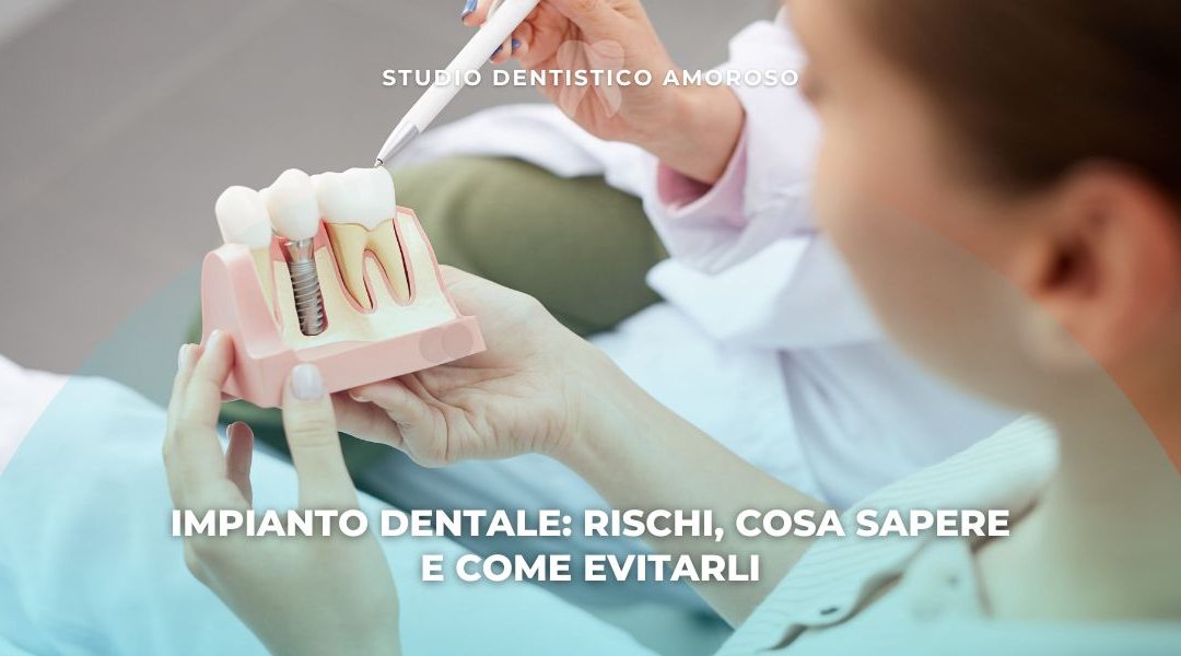 Impianto dentale: tutti i rischi spiegati in modo semplice (e come evitarli)