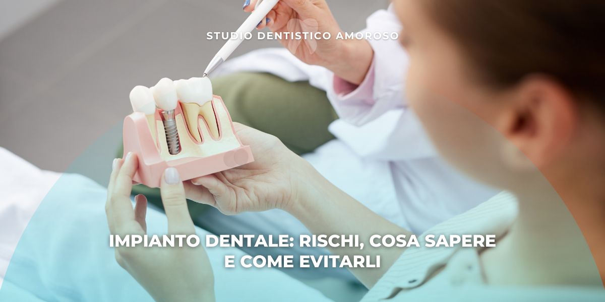 Dentista che mostra a un paziente un modello anatomico utilizzato per spiegare gli impianti dentali e i loro componenti.