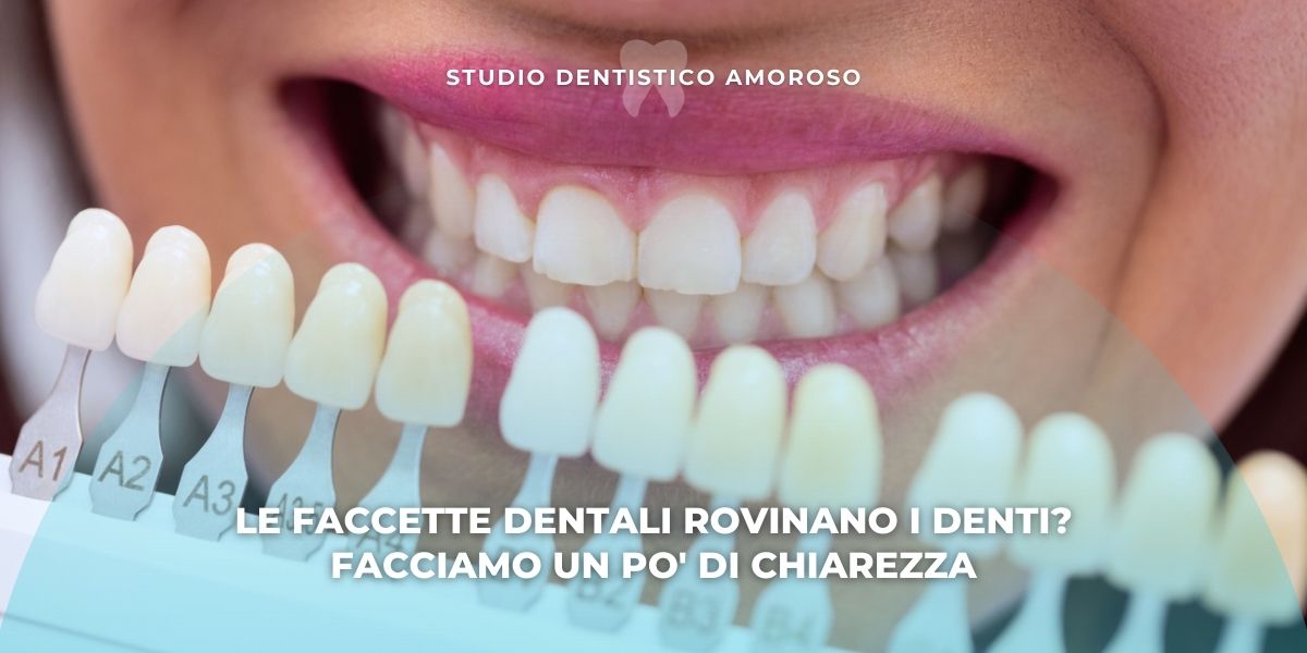 Sorriso con scala colori dentale davanti ai denti, esempio estetico per spiegare se le faccette dentali rovinano i denti.